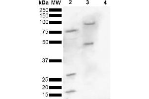 Western blot analysis of Human, Mouse brain lysate showing detection of ~16 kDa Alpha Synuclein pSer129 protein using Rabbit Anti-Alpha Synuclein pSer129 Polyclonal Antibody (ABIN5650949). (SNCA Antikörper  (pSer129) (HRP))