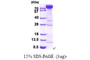 SDS-PAGE (SDS) image for phosphofructokinase, Muscle (PFKM) (AA 1-780) protein (His tag) (ABIN667782) (PFKM Protein (AA 1-780) (His tag))