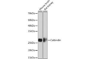 Western blot analysis of extracts of various cell lines, using Calbindin Rabbit mAb (ABIN1679483, ABIN3018777, ABIN3018778 and ABIN7101660) at 1:1000 dilution. (CALB1 Antikörper)