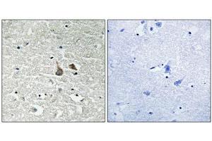 Immunohistochemical analysis of paraffin-embedded human brain tissue using IRAK1 (Phospho-Ser376) antibody (left)or the same antibody preincubated with blocking peptide (right). (IRAK1 Antikörper  (pSer376))