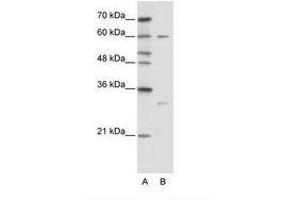 Image no. 1 for anti-Zinc Finger Protein 395 (ZNF395) (AA 361-410) antibody (ABIN6736114) (ZNF395 Antikörper  (AA 361-410))
