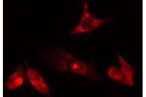 ABIN6274763 staining HuvEc cells by IF/ICC. (AZI1 Antikörper  (C-Term))