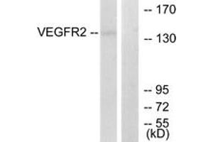 Western blot analysis of extracts from 293 cells, treated with LPS 100ng/ml 30', using VEGFR2 (Ab-1214) Antibody. (VEGFR2/CD309 Antikörper  (AA 1180-1229))