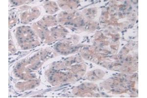 IHC-P analysis of Human Stomach Tissue, with DAB staining. (KEAP1 Antikörper  (AA 327-624))