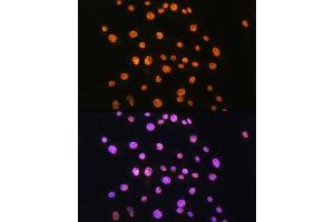 Immunofluorescence analysis of C6 cells using NR2F2 Rabbit pAb (ABIN6133831, ABIN6144820, ABIN6144821 and ABIN6214430) at dilution of 1:100. (NR2F2 Antikörper  (AA 1-100))