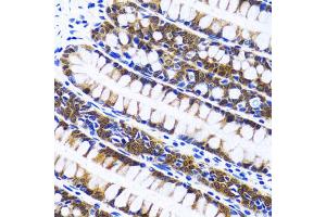 Immunohistochemistry of paraffin-embedded human colon using FASN antibody. (Fatty Acid Synthase Antikörper)