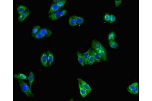 Immunofluorescent analysis of HepG2 cells using ABIN7153983 at dilution of 1:100 and Alexa Fluor 488-congugated AffiniPure Goat Anti-Rabbit IgG(H+L)