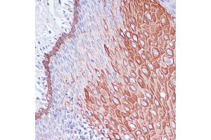 Immunohistochemistry (IHC) image for anti-WAS/WASL Interacting Protein Family, Member 1 (WIPF1) (AA 400-500) antibody (ABIN7271348)