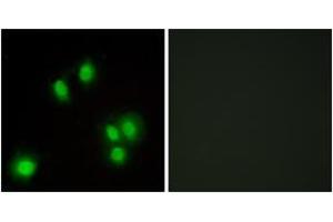 Immunofluorescence analysis of A549 cells, using GA45G Antibody. (GADD45G Antikörper  (AA 101-150))