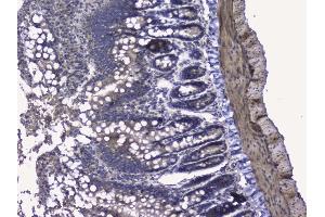 IHC analysis of RALBP1 using anti-RALBP1 antibody (ABIN5692936). (RALBP1 Antikörper  (AA 239-506))