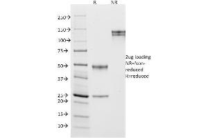 SDS-PAGE (SDS) image for anti-Membrane Metallo-Endopeptidase (MME) (AA 297-483) antibody (ABIN6940058)