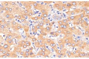 Immunohistochemistry of paraffin-embedded Human liver using PDCD2L Polyclonal Antibody at dilution of 1:100 (40x lens). (PDCD2L Antikörper)