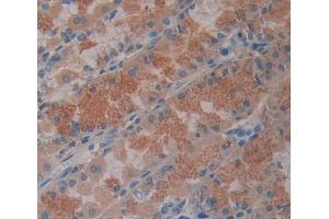Used in DAB staining on fromalin fixed paraffin- embedded stomach tissue (ABCB8 Antikörper  (AA 472-735))