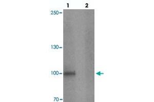 Western blot analysis of STOX1 in human liver tissue with STOX1 polyclonal antibody  at 1 ug/mL in (lane 1) the absence and (lane 2) the presence of blocking peptide. (STOX1 Antikörper  (C-Term))