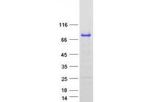 Western Blotting (WB) image for SH3-Domain Binding Protein 2 (SH3BP2) (Transcript Variant 2) protein (Myc-DYKDDDDK Tag) (ABIN2731973)