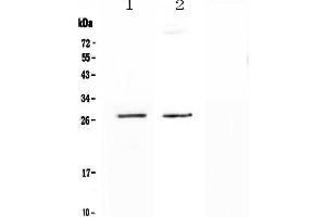 Western blot analysis of SPR using anti-SPR antibody . (SPR Antikörper  (AA 36-261))