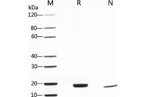 2 μg of IL-6, Human was resolved with SDS-PAGE under reducing (R) and non-reducing (N) conditions and visualized by Coomassie Blue staining. (IL-6 Protein (AA 29-212))