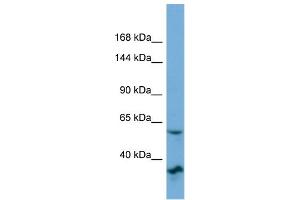Host:  Rabbit  Target Name:  OSBP2  Sample Type:  OVCAR-3 Whole cell lysates  Antibody Dilution:  1.
