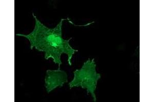 Anti-LIMK1 mouse monoclonal antibody (ABIN2454574) immunofluorescent staining of COS7 cells transiently transfected by pCMV6-ENTRY LIMK1 (RC218058). (LIM Domain Kinase 1 Antikörper)