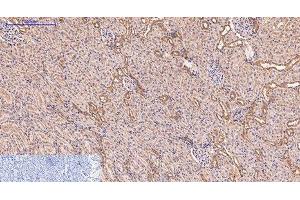 Immunohistochemistry of paraffin-embedded Rat kidney tissue using CD5 Monoclonal Antibody at dilution of 1:200. (CD5 Antikörper)