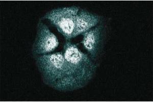 Immunofluorescence staining of A431 cells. (RAP1 Antikörper  (AA 1-184))