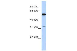DDX28 antibody used at 1 ug/ml to detect target protein. (DDX28 Antikörper)