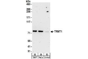 anti-tRNA Methyltransferase 1 (TRMT1) (AA 609-659) antibody