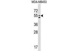 Western Blotting (WB) image for anti-phosphatidylserine Synthase 1 (PTDSS1) antibody (ABIN2999231) (PTDSS1 Antikörper)