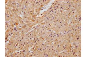 IHC image of ABIN7175041 diluted at 1:100 and staining in paraffin-embedded human heart tissue performed on a Leica BondTM system. (C22ORF39 Antikörper  (AA 1-142))