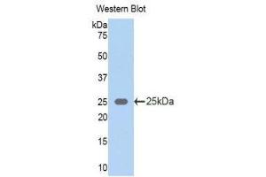 Western Blotting (WB) image for anti-Keratin 5 (KRT5) (AA 335-473) antibody (ABIN1172972)