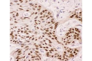 Immunohistochemistry (IHC) image for anti-T-Complex 1 (TCP1) (AA 311-680) antibody (ABIN3029088)