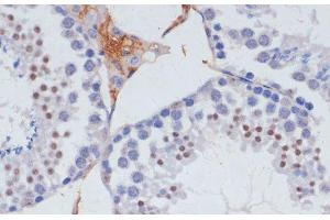 Immunohistochemistry of paraffin-embedded Mouse testis using SKIV2L2 Polyclonal Antibody at dilution of 1:100 (40x lens). (MTR4 Antikörper)