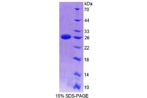 SDS-PAGE (SDS) image for Excision Repair Cross-Complementing Rodent Repair Deficiency, Complementation Group 2 (ERCC2) (AA 404-637) protein (His tag) (ABIN6238937) (ERCC2 Protein (AA 404-637) (His tag))