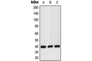 Western blot analysis of GPR160 expression in LO2 (A), mouse liver (B), rat kidney (C) whole cell lysates. (GPR160 Antikörper  (C-Term))