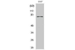 Western Blotting (WB) image for anti-Tyrosinase (TYR) (C-Term) antibody (ABIN3187389) (TYR Antikörper  (C-Term))