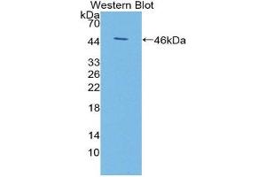 Western Blotting (WB) image for anti-KiSS-1 Metastasis-Suppressor (KISS1) (AA 1-126) antibody (ABIN1868842) (KISS1 Antikörper  (AA 1-126))