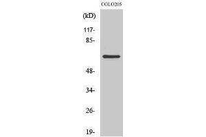 Western Blotting (WB) image for anti-Coenzyme Q8A (COQ8A) (Internal Region) antibody (ABIN3179898) (COQ8A Antikörper  (Internal Region))