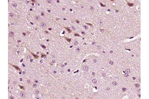 Paraformaldehyde-fixed, paraffin embedded mouse brain, Antigen retrieval by boiling in sodium citrate buffer (pH6) for 15min, Block endogenous peroxidase by 3% hydrogen peroxide for 30 minutes,  Blocking buffer (normal goat serum) at 37°C for 20min, Antibody incubation with LPCAT2 Polyclonal Antibody (bs-10742R) at 1:400 overnight at 4°C, followed by a conjugated secondary and DAB staining. (LPCAT2 Antikörper  (AA 131-230))