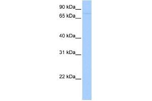 SAMD4A antibody used at 1 ug/ml to detect target protein.