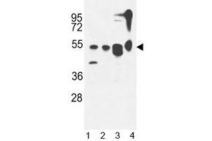 ATG13 antibody western blot analysis in 1) MDA-MB435,2) CEM, 3) T47D cell line and 4) mouse cerebellum tissue lysate. (ATG13 Antikörper  (AA 1-30))