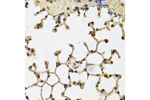 Immunohistochemistry of paraffin-embedded mouse lung using IFI16 Antibody. (IFI16 Antikörper)