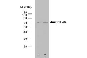Western blot analysis of HeLa whole cell lysate (1) and HeLa heat stressed whole cell lysate (2) probed with RAT ANTI CCT ETA (ABIN119787) followed by F(ab')2 RABBIT ANTI RAT IgG:HRP (ABIN119759). (CCT7 Antikörper)