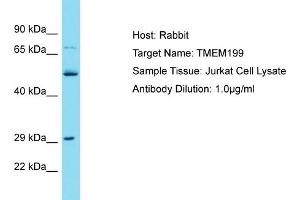 Host: Rabbit Target Name: TMEM199 Sample Tissue: Human Jurkat Whole Cell Antibody Dilution: 1ug/ml (TMEM199 Antikörper  (N-Term))