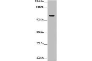 Western blot All lanes: EHD1 antibody at 12 μg/mL + MDA-MB-231 whole cell lysate Secondary Goat polyclonal to rabbit IgG at 1/10000 dilution Predicted band size: 61 kDa Observed band size: 61 kDa (EHD1 Antikörper  (AA 401-498))