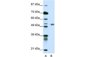 WB Suggested Anti-DEAF1 Antibody Titration:  0. (DEAF1 Antikörper  (C-Term))