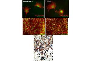 Immunohistochemistry (Paraffin-embedded Sections) (IHC (p)) image for anti-Protein Kinase C and Casein Kinase Substrate in Neurons 2 (PACSIN2) (AA 342-371), (C-Term) antibody (ABIN392666)