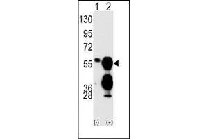 Image no. 1 for anti-Protein Phosphatase 1F (PP2C Domain Containing) (PPM1F) (C-Term) antibody (ABIN360801) (PPM1F Antikörper  (C-Term))