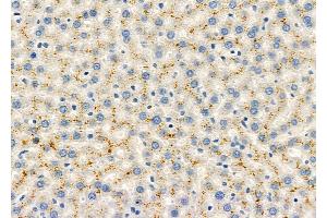 ABIN6260828 and ABIN6279058 at 1/100 staining Rat liver tissue by IHC-P.