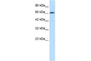 Western Blot showing ZNF499 antibody used at a concentration of 1-2 ug/ml to detect its target protein.