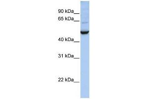 IDH1 antibody used at 1 ug/ml to detect target protein. (IDH1 Antikörper)